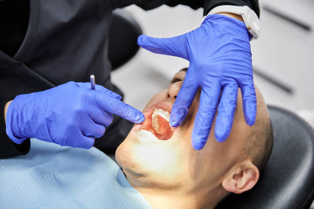 Best Urgent Care for Lost Fillings or Crowns in Buckhorn, CA